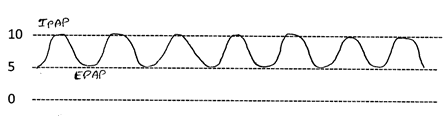 BiPAP pressure curve