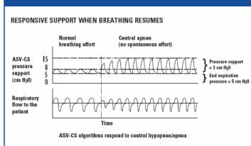 ResMed ASV pressure curve