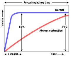 time volume curve in COPD