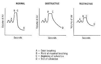 What is mild restrictive lung disease?