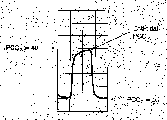 PetCO2 curve-single breath