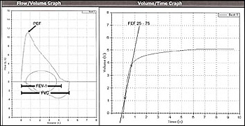 spirometry graphs